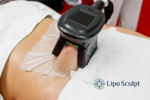 Cryolipolysis Helping You Getting that Perfect Summer Body 3 Cryolipolysis Sandringham can give you the best summer body - contact us today!