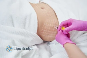 Are The Results From Aqualyx Permanent? 1 Do you want to know how long Aqualyx Sandringham results last?